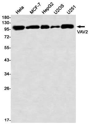 VAV2 Rabbit mAb